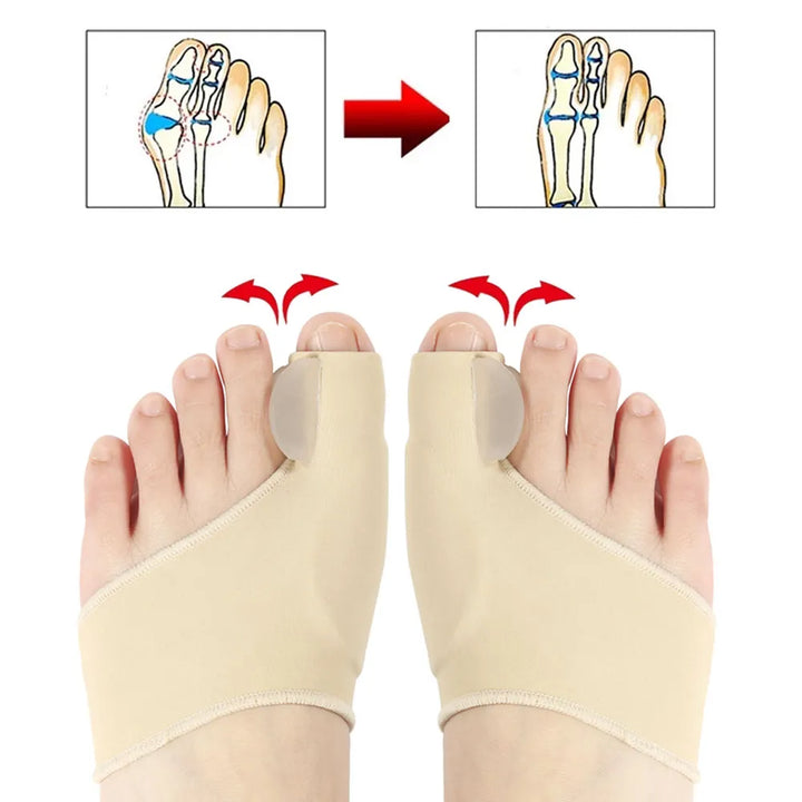 Bunion Corrector Toe Separator
