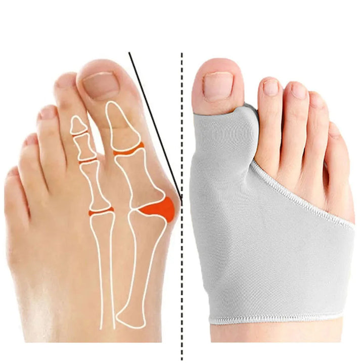 Bunion Corrector Toe Separator